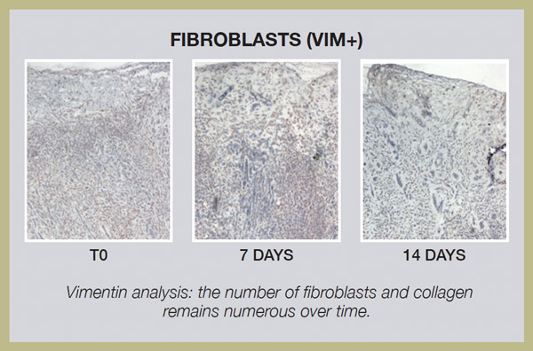 Fibroblasts